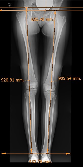 biomecanica3