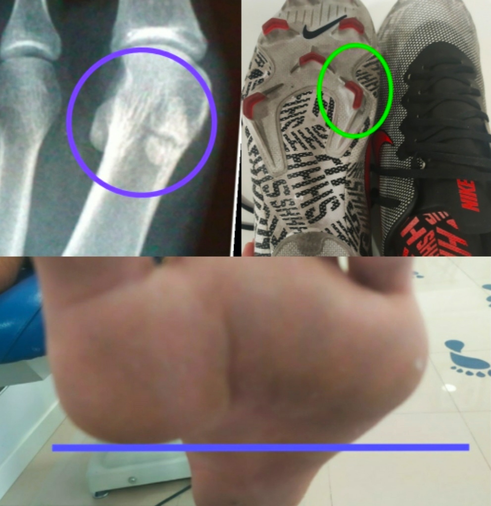 biomecanica4