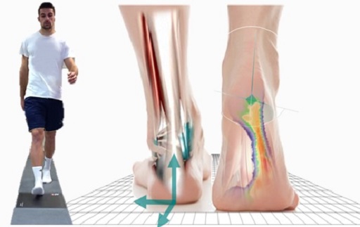 running-estudio-biomecanico-cetep running estudio biomecanico cetep